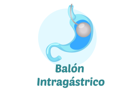 BALÓN INTRAGÁSTRICO