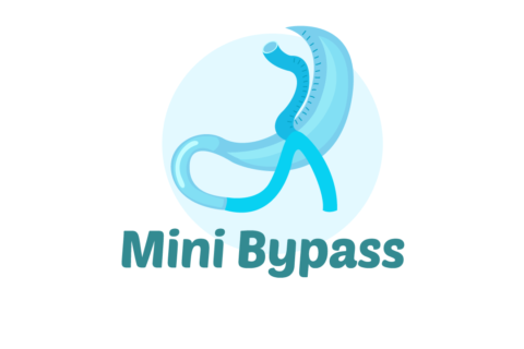 MINI BYPASS GÁSTRICO